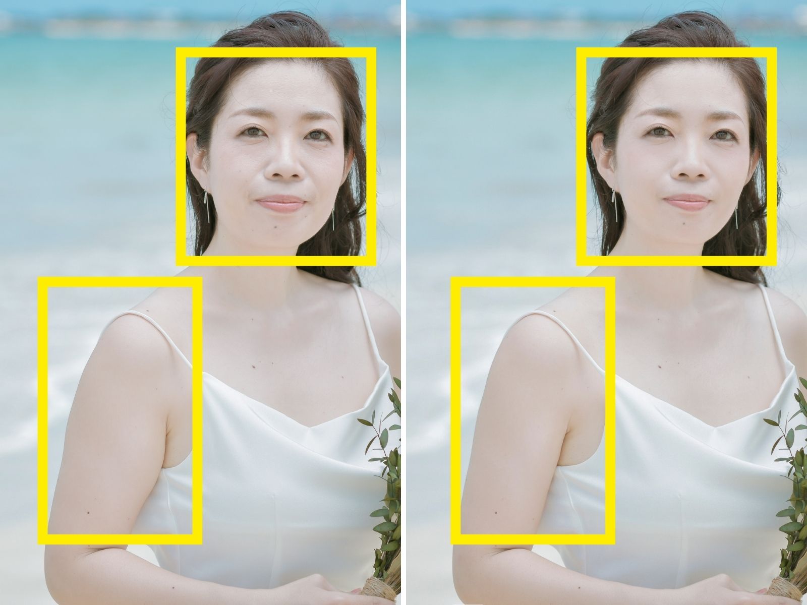 小顔補正と二の腕シェイプ